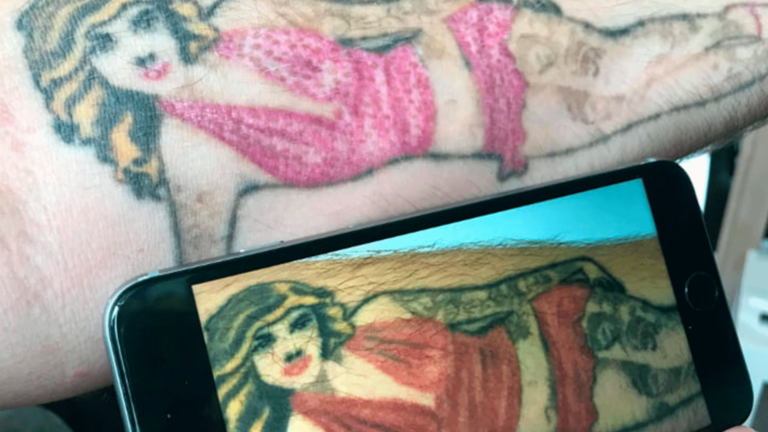 Tattoo Remove - Efter behandling - Frisør Karma Thisted